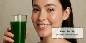 قاتل جوش صورت