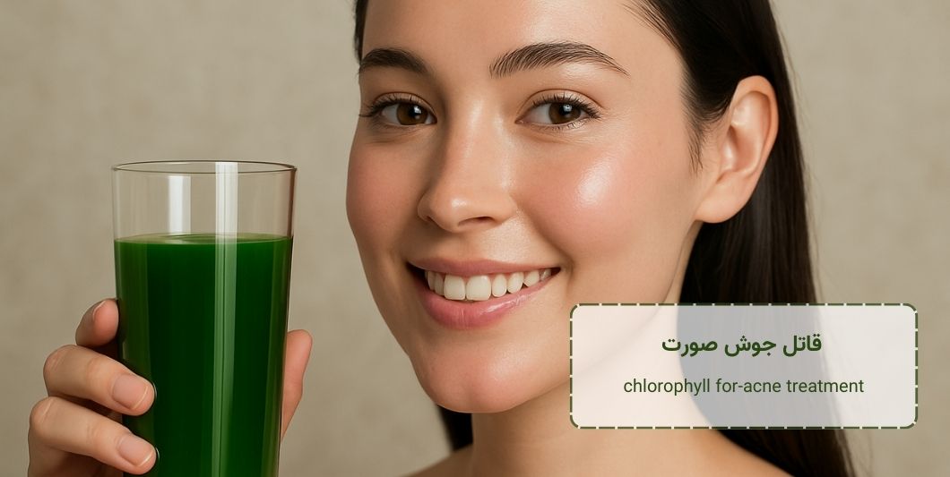 قاتل جوش صورت